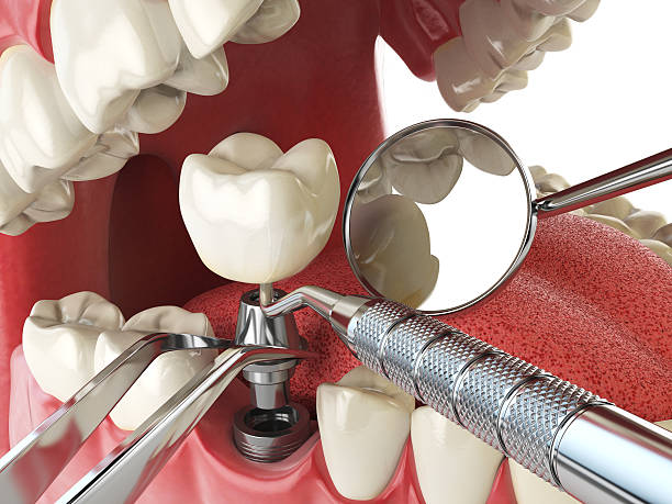 Best Emergency Treatment for Toothache in Eureka Springs, AR