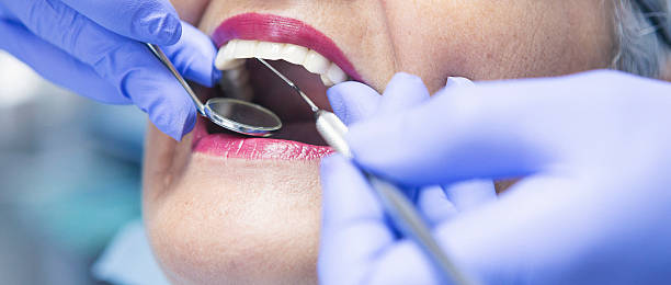 Best Emergency Tooth Extraction in Eureka Springs, AR