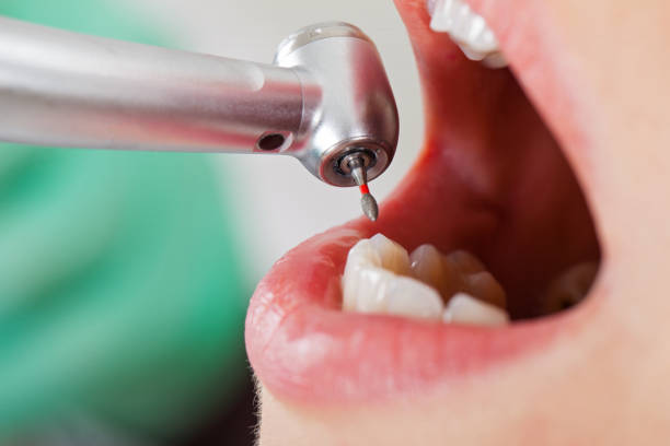 Best Emergency Dental Care for Trauma or Injury in Eureka Springs, AR